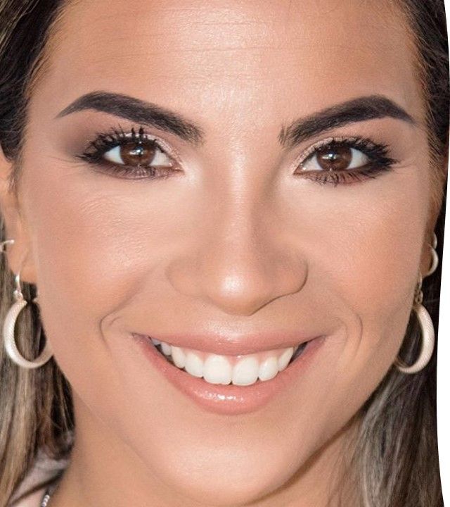 Coni